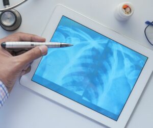 x rays of chest on a tablet